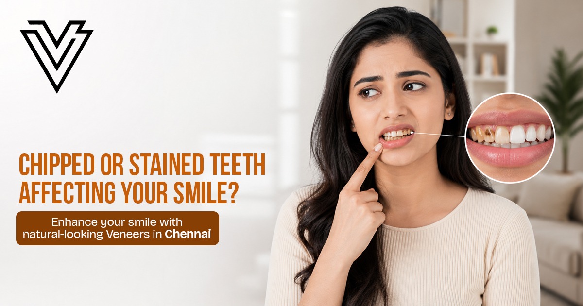 Correct Chipped and Stained Teeth with Veneers in Chennai