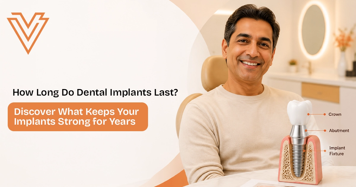 How Long Do Dental Implants Last and What Affects Their Lifespan?