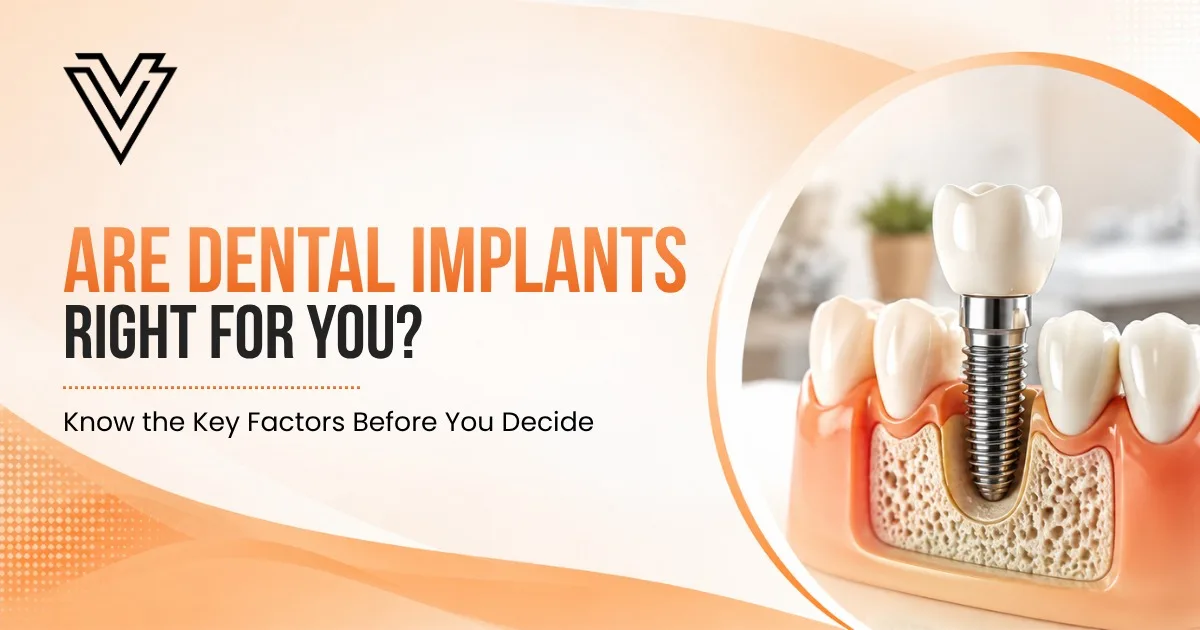 Who Is the Right Candidate for Dental Implants? Expert Answers Before You Decide