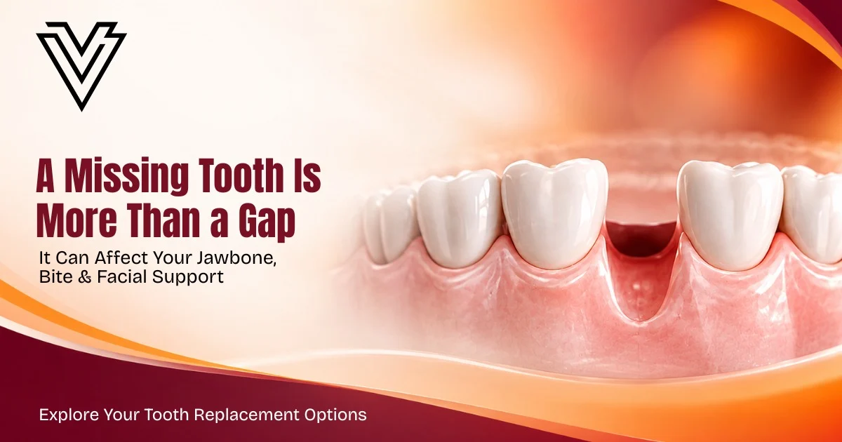 Can a Missing Tooth Affect Your Jawbone and Facial Appearance?